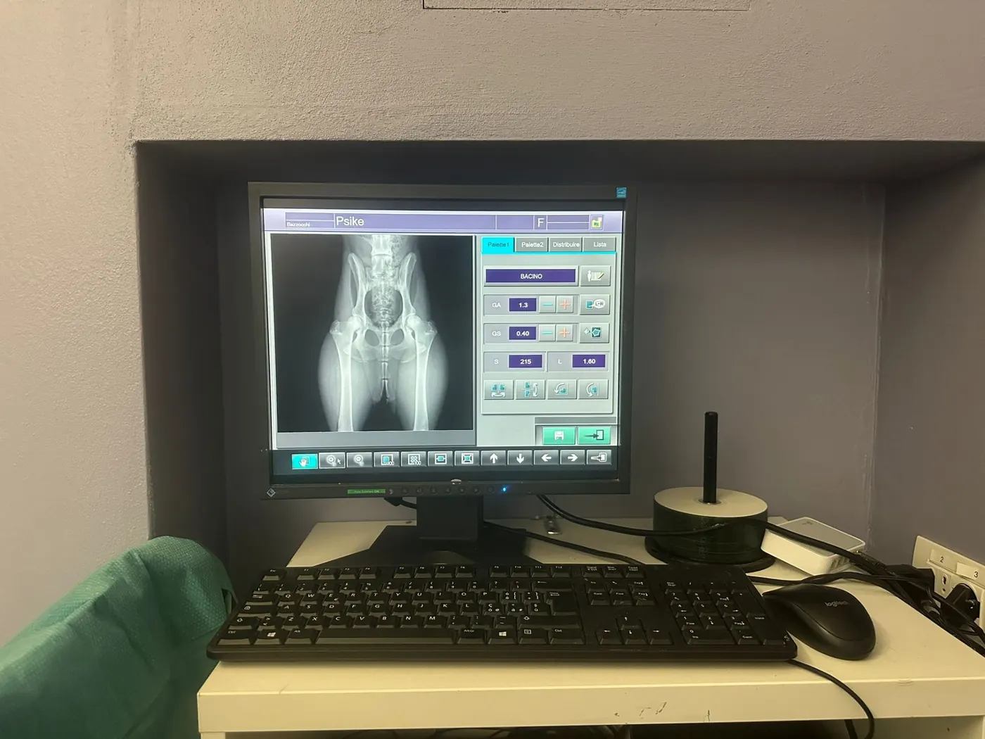 Monitor radiografico digitale